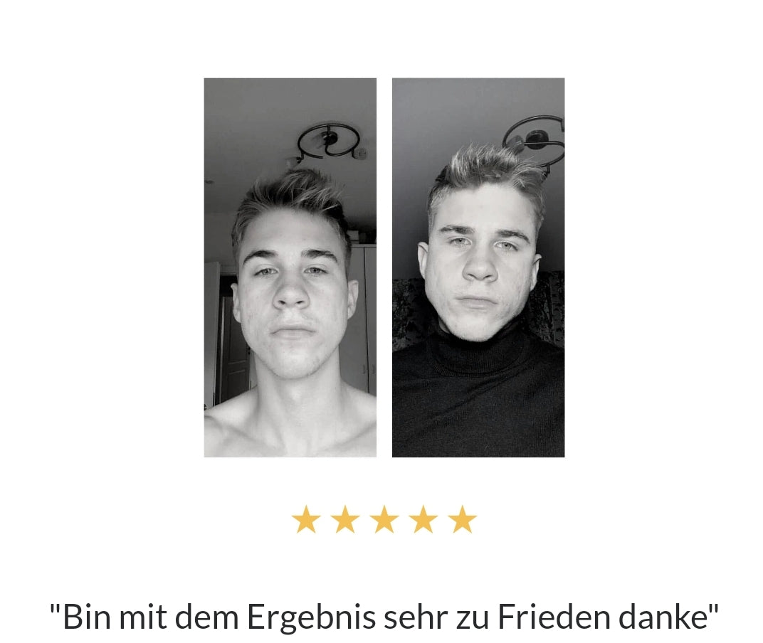 Le JAWLINER® 3.0 est spécialement conçu pour renforcer et sculpter les muscles de votre mâchoire grâce à des exercices ciblés et efficaces.