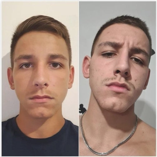 Le JAWLINER® 3.0 est spécialement conçu pour renforcer et sculpter les muscles de votre mâchoire grâce à des exercices ciblés et efficaces.